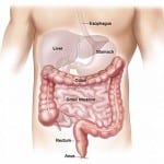 colon cleansing