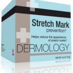 stretch mark creams