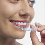 Does Invisalign really work?