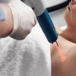 Does laser hair removal really work?