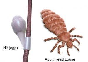 Head Lice and Nits