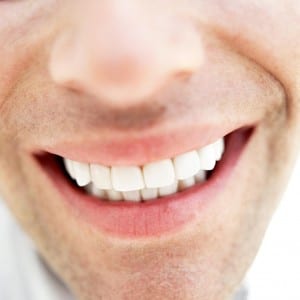 Does teeth whitening really work?