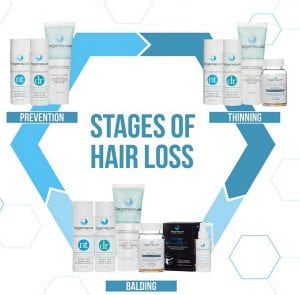 Hair Loss