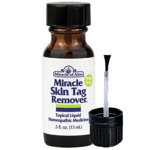Does Miracle of Aloe Miracle Skin Tag Remover work?