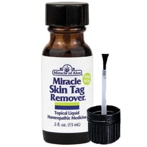 How To Get Rid Of Skin Tags On Face